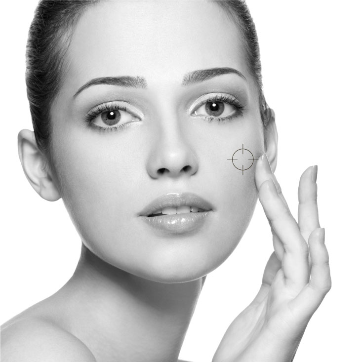 imagen tratamiento pieles con tendencia acneica